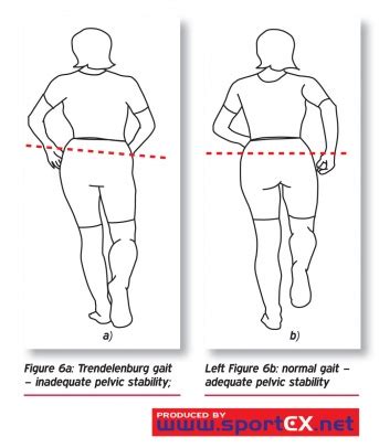 hip drop test|positive trendelenburg sign causes.